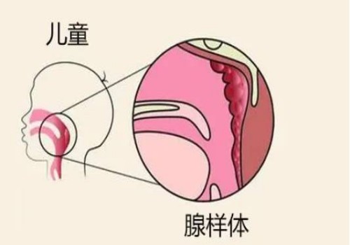 移植失败后快速恢复卵巢方法分享，请记住了