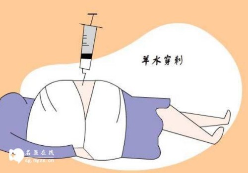 染色体缺失对生育有什么影响,男性染色体缺失的原因